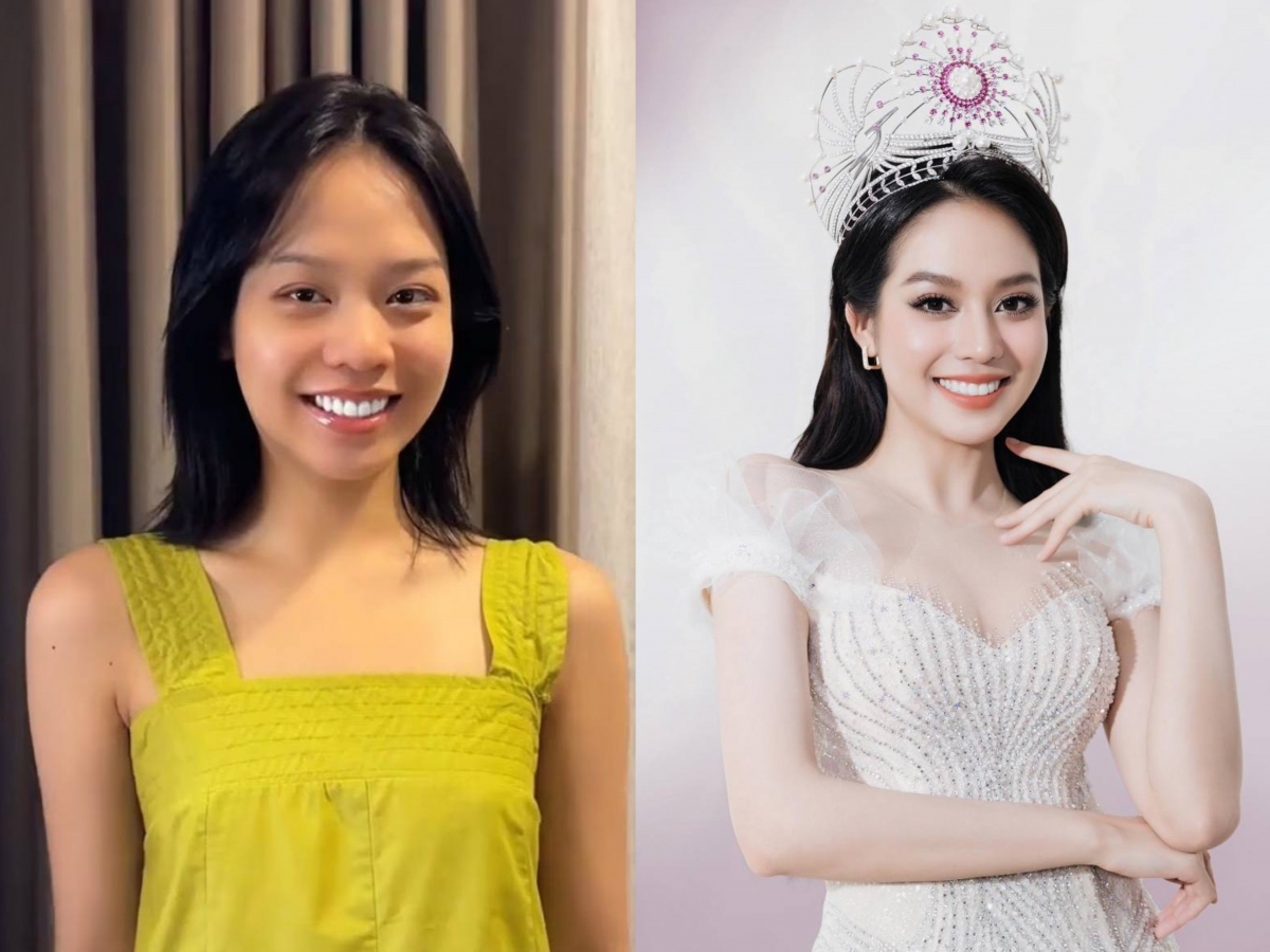 Vừa đăng quang, Hoa hậu Thanh Thuỷ thừa nhận phẫu thuật thẩm mỹ