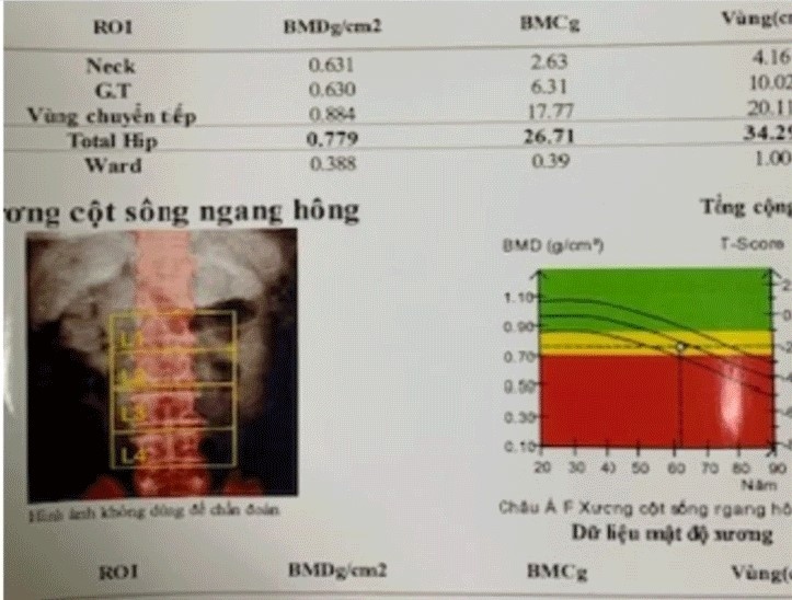 Tự ý mua thuốc điều trị, bác sĩ chỉ ra hậu quả khôn lường