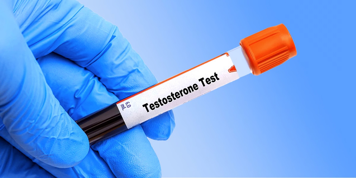 Những điều nam giới nên biết khi kiểm tra Testosterone